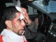 ماموران امنیتی آل خلیفه به تظاهركنندگان بحرینی حمله کردند