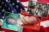 حضور نظامی آمریکا در افغانستان و افزایش بیماری ها در این کشور