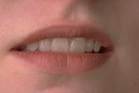 چند روش طبيعي و غيرشيميايي براي سفيد كردن دندانها