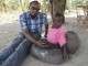 پسری با پاهای فیلی در اوگاندا
