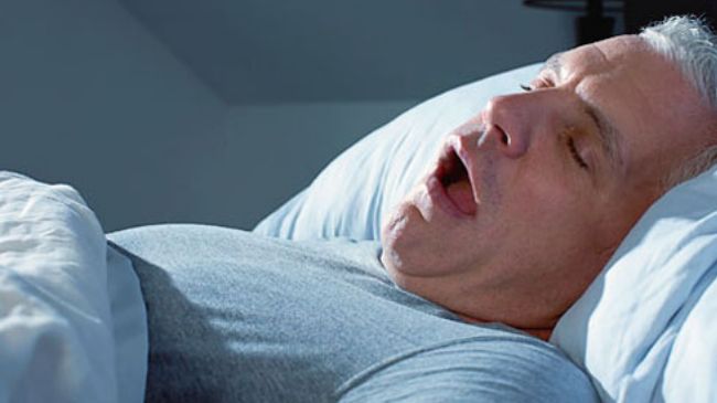 Sleep apnea associated with higher cancer death