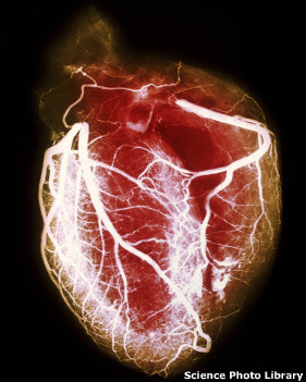استفاده از ترکاری خطر بیماریهای قلبی را ۳۲% کاهش می‌دهد