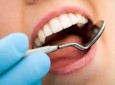 پژوهشگران از سلول‌های لثه دندان رویاندند