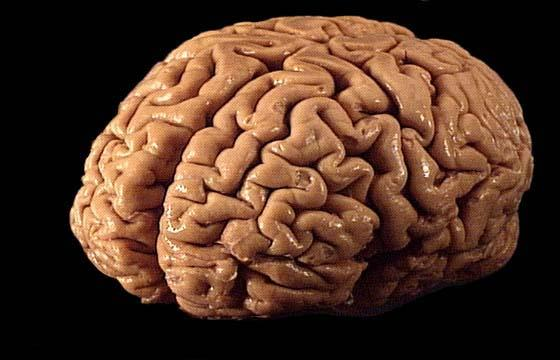 شبیه سازی مغز انسان