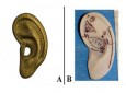 ساخت گوش مصنوعی از غضروف انسان و تیتانیوم