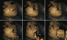 چگونگی لمس صورت و سر جنین نشانه ای برای میزان رشد جسمی و روانی