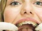 درد دندانتان را در خانه درمان کنید