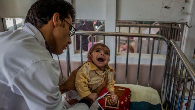معاینه یک کودک  چهاده ماهه در شفاخانه اطفال ایندیرا گاندی در کابل