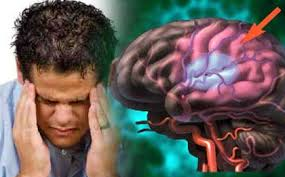 اثر بی خوابی بر مغز، مشابه ضربه مغزی است
