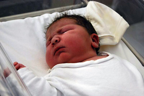 تولد بزرگترين نوزاد دنيا با وزن 6 و دو دهم كيلوگرم در اسپانيا