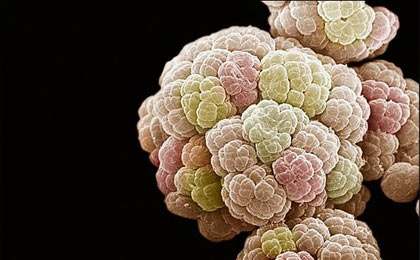 پروتئین "حیات" به جای شیمی درمانی سرطان سینه