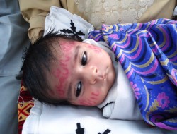 آشكار شدن "يا الله" و "يا محمد" در چهره نوزاد هشت ماهه در غزني