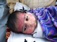 آشكار شدن "يا الله" و "يا محمد" در چهره نوزاد هشت ماهه در غزني