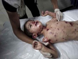 سلاح غیر متعارف برای شکار کودکان غزه