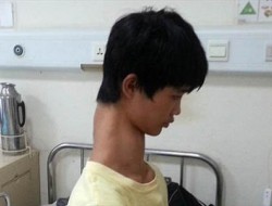 پسری که از بلندی گردنش رنج می‌برد