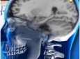ساختار مغزی افراد خطرپذیر چگونه است؟