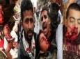 دهها کشته در حمله نیروهای امنیتی یمن