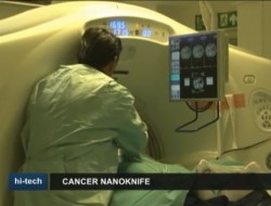 روش «نانونایف» روشی جدید برای کنترول سرطان