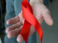 کشف منشاء دقیق ایدز پس از ۳۰ سال