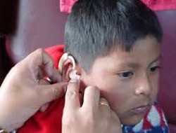 به ۶۵۰ کودک ناشنوا در کابل، آله های شنوایی(سمعک) داده شد