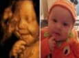 سونوگرافی ۴ بعدی از شادترین جنین دنیا