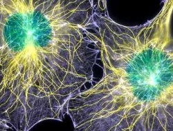 کشف آنزیم دخیل در رشد سلول سرطانی