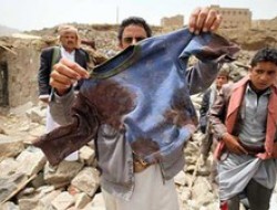 حزب‌الله: کشتار زنان و کودکان یمن، چهره واقعی ‌ عربستان آشکار کرد