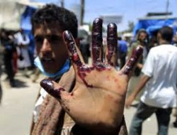یمن، خط مقدم جنگ با بزرگترین حامی تروریزم