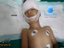 کودک یمنی قبل از شهادت: "دفنم نکنید" + فلم