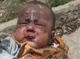 کودکان یمن قربانیان تجاوز آل سعود