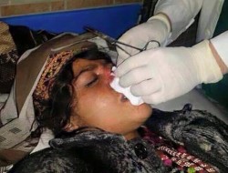 واکنش کمیسیون حقوق بشر افغانستان به بریده شدن بینی یک زن در فاریاب