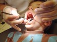 عادت‌هایی که باعث خرابی دندان می‌شود