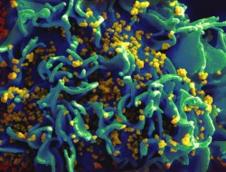 درمان ایدز با آنتی بادی‌های سرطان