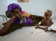 جنایات عربستان سعودی و اطفال  قحطی زده یمنی