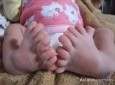 تولد نوزادی با ۳۱ انگشت در چین