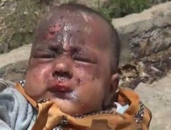کشته و زخمی شدن حدود ۳هزار کودک یمنی توسط عربستان