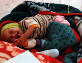 بیش از 2 میلیون کودک یمنی دچار سوءتغذیۀ حاد هستند