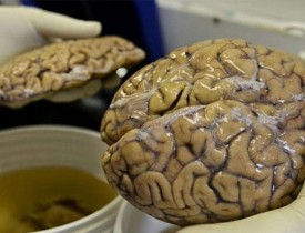 بزرگترین «بانک مغز» جهان در هاروارد