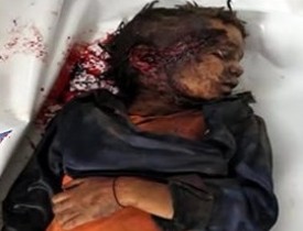 کشته شدن شش طفل یمنی در بمباران جنگنده های عربستانی