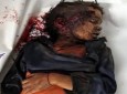 کشته شدن شش طفل یمنی در بمباران جنگنده های عربستانی