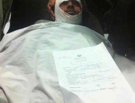 فردی که در انفجار تروریستی شهر هرات زخمی شده است.
