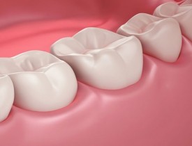 چگونه می توانیم از پوسیدگی دندانها پیشگیری کنیم؟