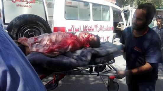 43 کشته و 109 زخمی در حمله انتحاری امروز کابل