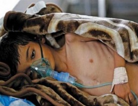 هر شش دقیقه یک کودک یمنی به وبا مبتلا می شود