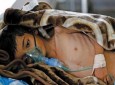 هر شش دقیقه یک کودک یمنی به وبا مبتلا می شود