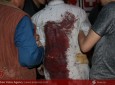 تصاویر اختصاصی خبرگزاری صدای افغان(آوا) از حمله تروریستی به مسجد امام زمان(عج)  