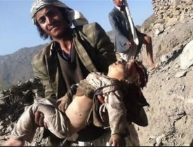 سکوت انگلیس در قبال تجاوزگری سعودی ها به یمن