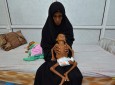 سازمان ملل درخصوص سوء تغذیه حاد کودکان روهینگیایی هشدار داد