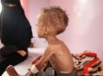 تشدید قحطی و گسترش وبا در یمن