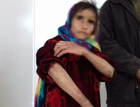 12 Year-Old Girl Beaten, Tortured to Death by Husband in Ghor